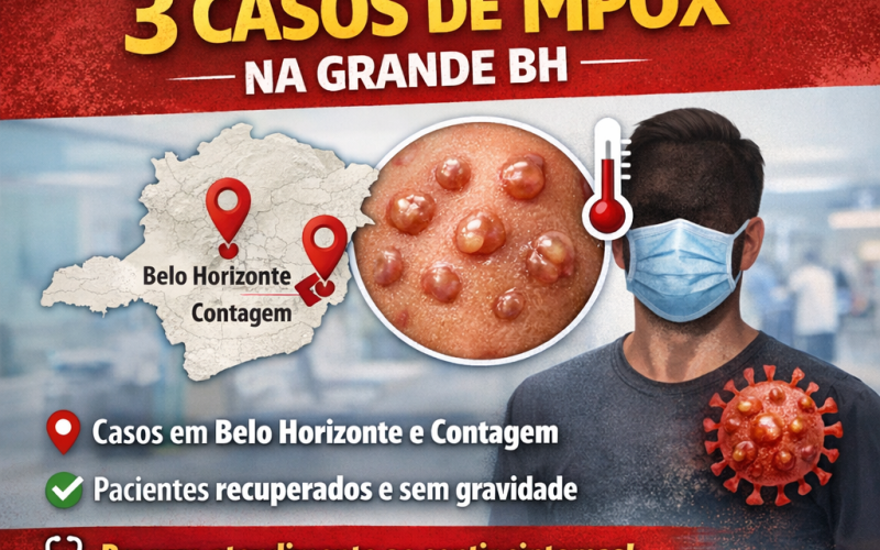 MG confirma três casos de Mpox na Grande BH e reforça alerta sanitário.
